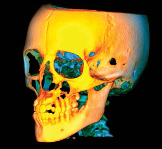 3D X-ray skull cbct orthodontic