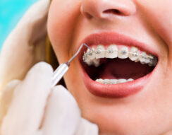 Orthodontics in Hendersonville TN