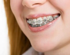 Expert Orthodontist treating a patient with braces in Hendersonville, Goodlettsville, Madison, and Nashville, TN
